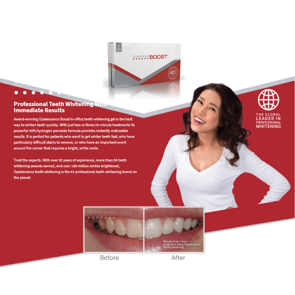 Teeth Whitening Gel Opalescence - 오팔레센스 부스트 40% PF 아메리칸 울트라덴트
