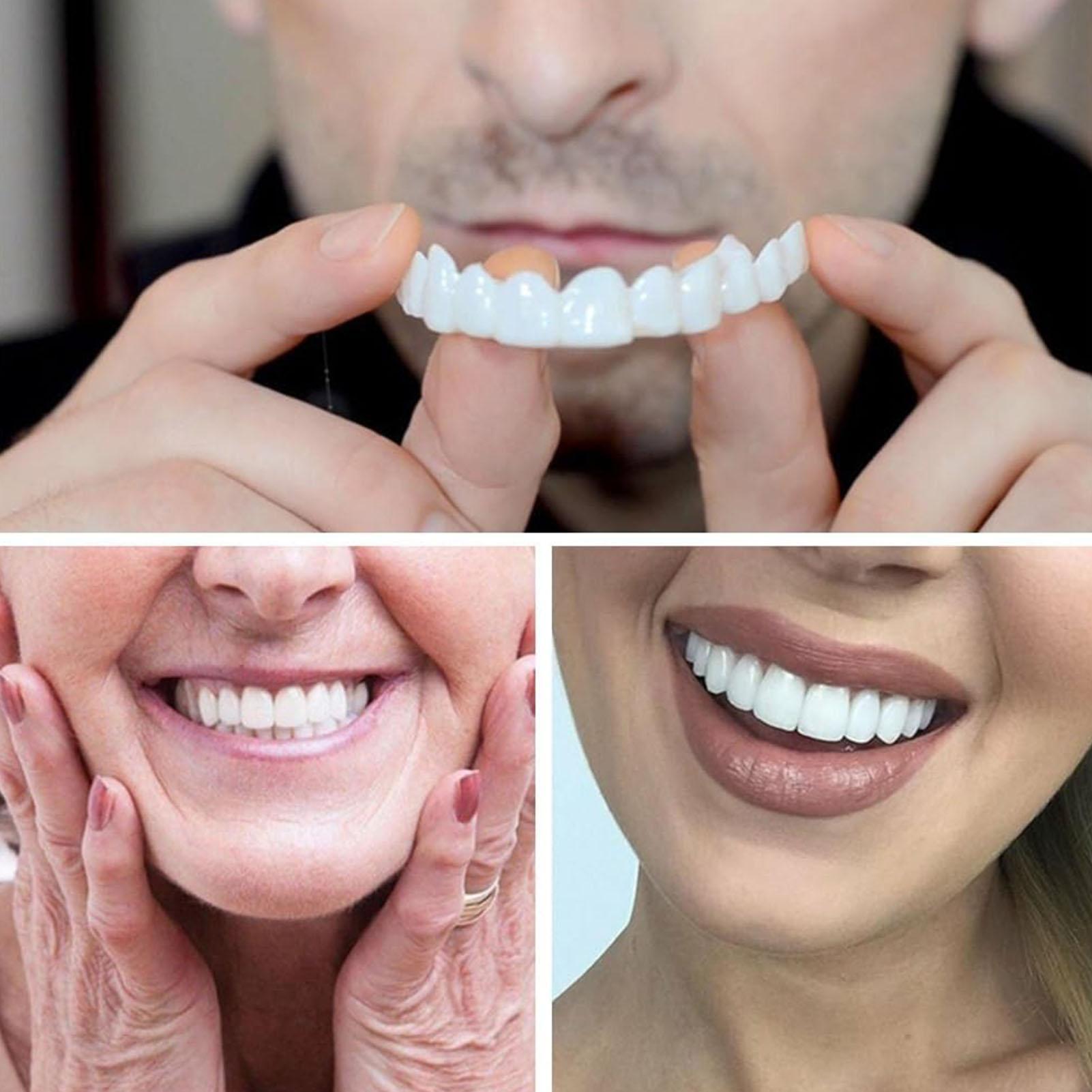 스냅온 치아 키트 가짜 임시 치아 미백 교체용 임시 치 - Teeth Whitening In Office 리뷰 및 가격