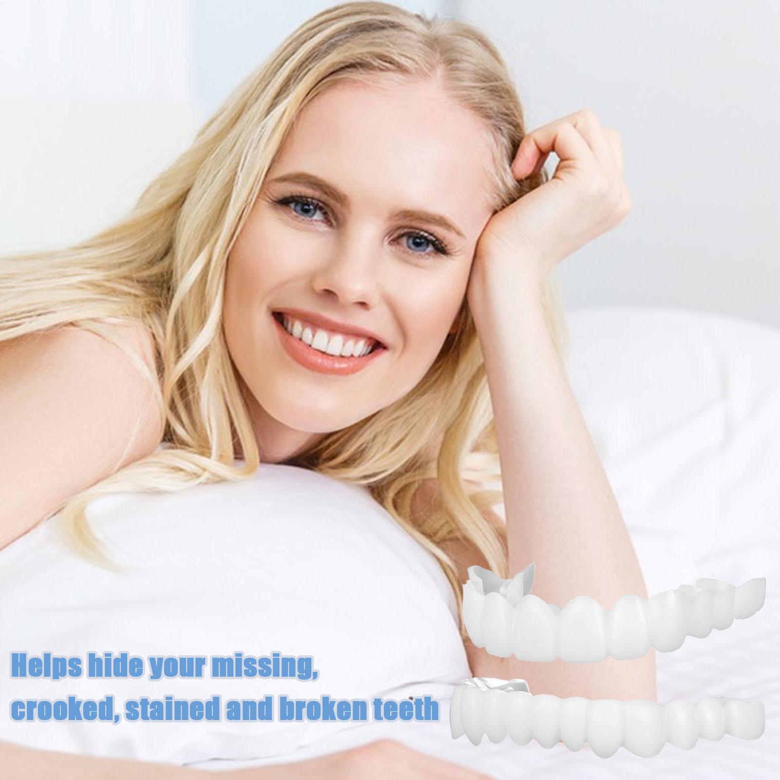 스냅온 치아 키트 가짜 임시 치아 미백 교체용 임시 치 - Teeth Whitening In Office 리뷰 및 가격