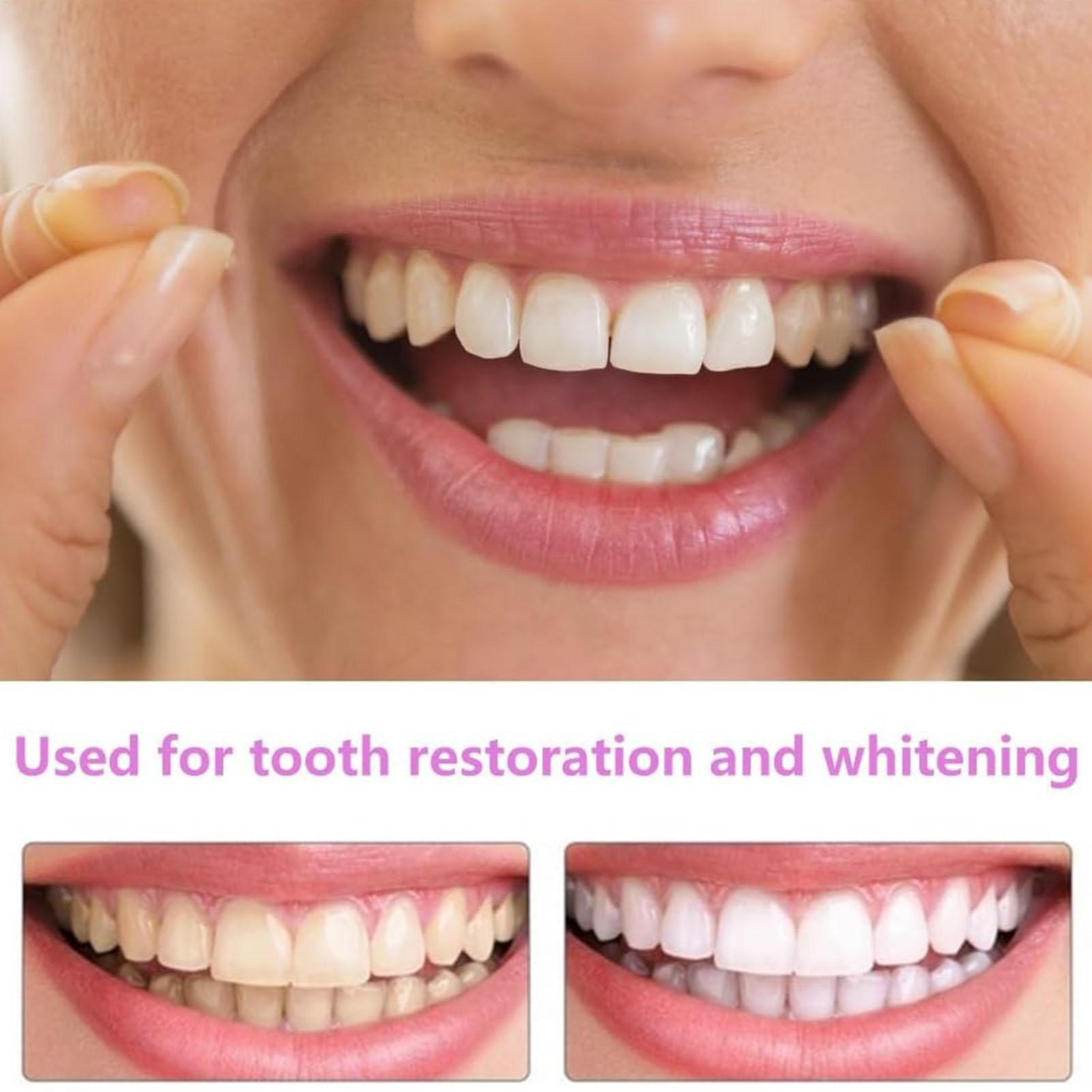 스냅온 치아 키트 가짜 임시 치아 미백 교체용 임시 치 - Teeth Whitening In Office 리뷰 및 가격