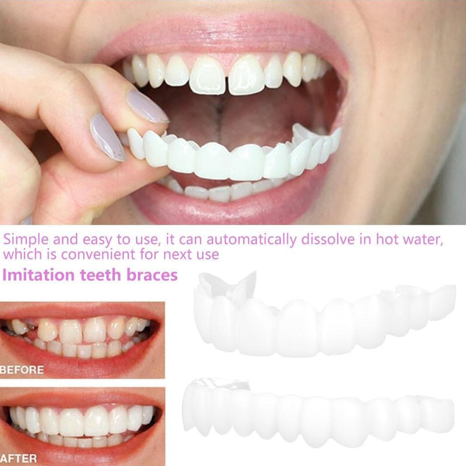 스냅온 치아 키트 가짜 임시 치아 미백 교체용 임시 치 - Teeth Whitening In Office 리뷰 및 가격