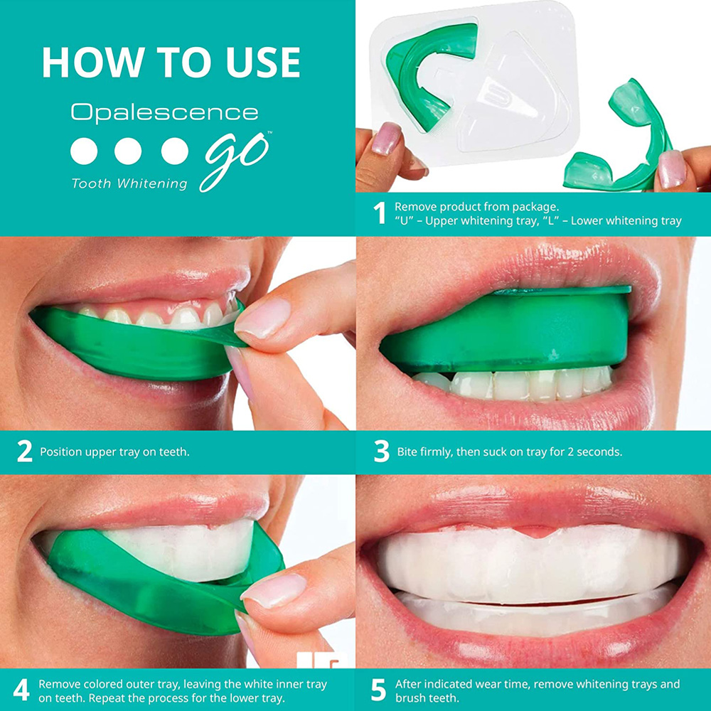 치아 미백용 과산화 수소, 유백광 고 프리필 트레이,  - Teeth Whitening In Office 리뷰 및 가격