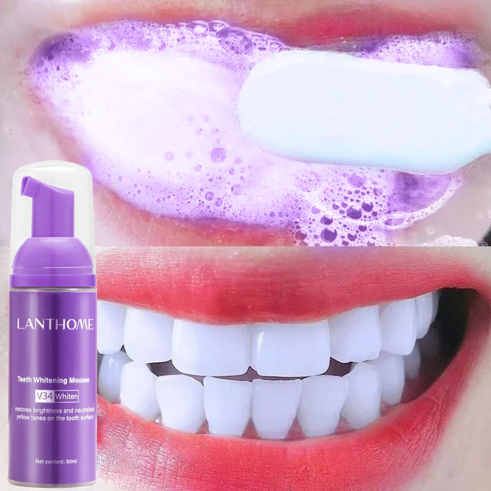 V34 무스 치아 청소 치약 효과적인 브라이트닝 치아  - Teeth Whitening Yellow Teeth 리뷰 및 가격