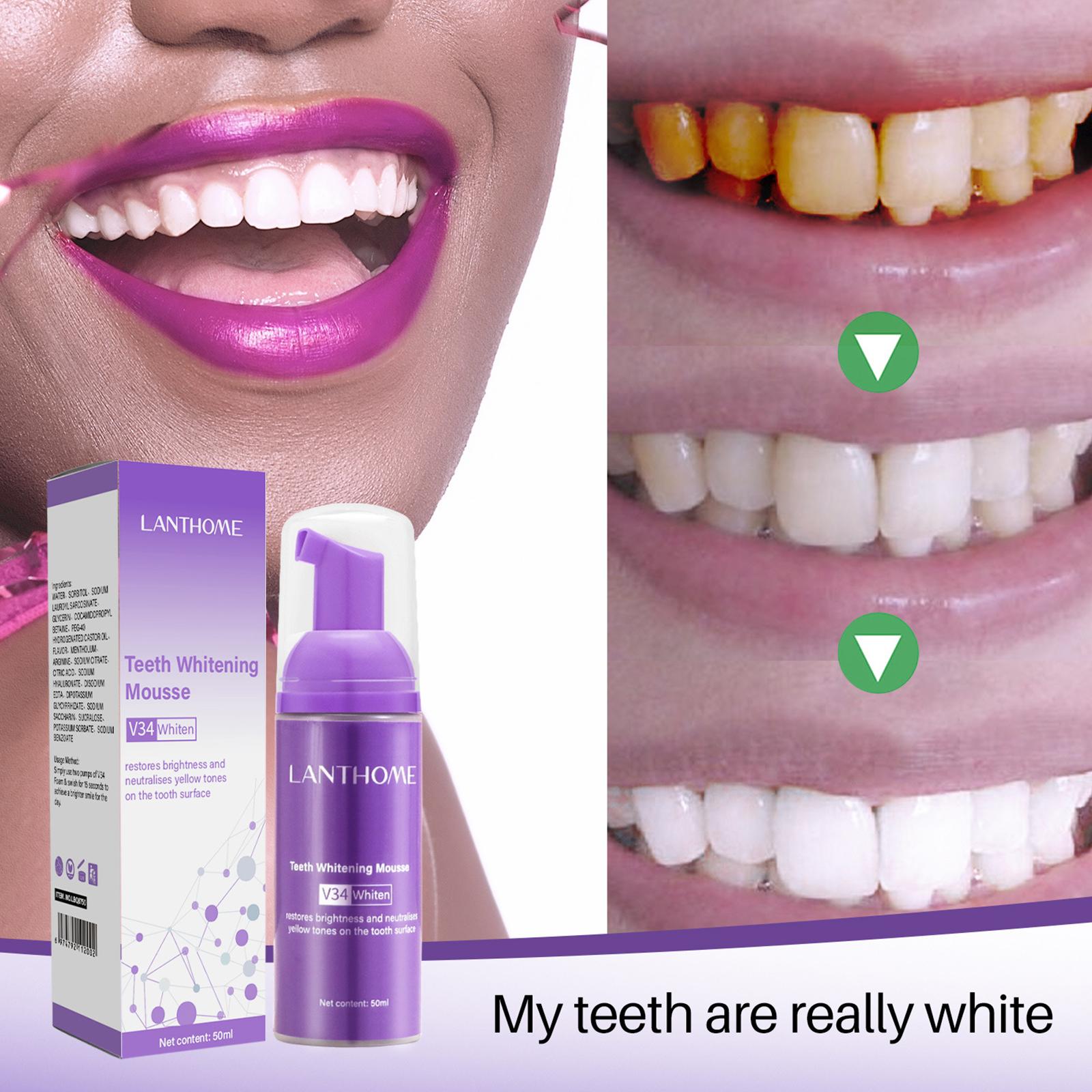 V34 무스 치아 청소 치약 효과적인 브라이트닝 치아  - Teeth Whitening Yellow Teeth 리뷰 및 가격