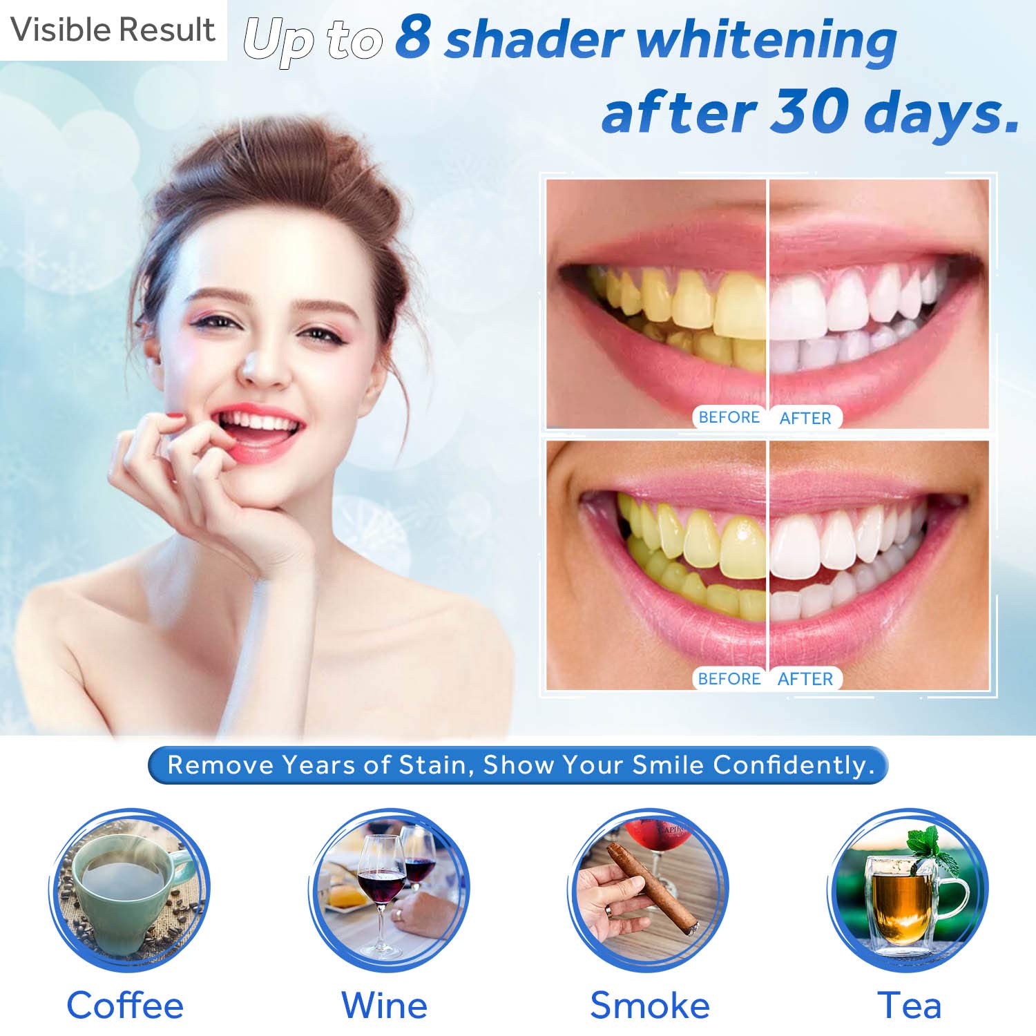 치아 미백 젤 리필 주사기 치아 미백 젤 인비스알라인  - Teeth Whitening Diy 리뷰 및 가격