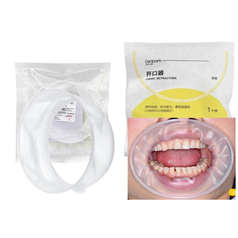20Pcs 덴트파크 O자형 구강 치크 리트랙터 일회용  - Teeth Whitening Clinic 리뷰 및 가격