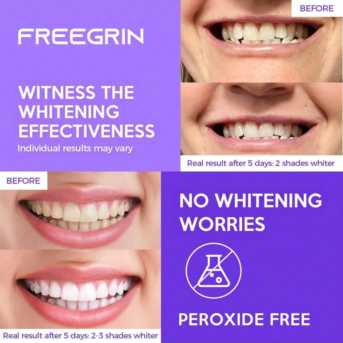 디럭스 화이트닝 치아 스티커 7/14/21 쌍 젤 화이 - Teeth Whitening In Office 리뷰 및 가격