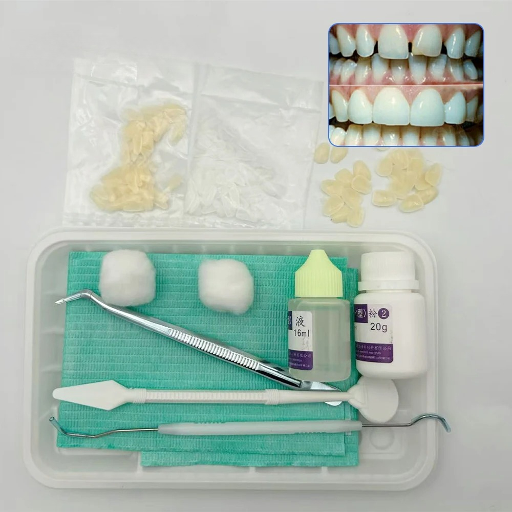 전치부 자가 접착 초박형 임시 베니어 – 연습용 레진  - Teeth Whitening Yellow Teeth 리뷰 및 가격