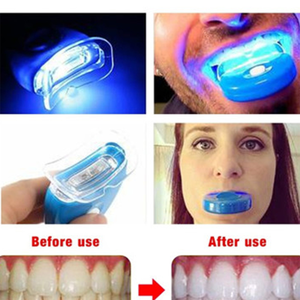 블루 LED 치아 미백 가속기, UV 라이트 치과 레이 - Teeth Whitening In Office 리뷰 및 가격