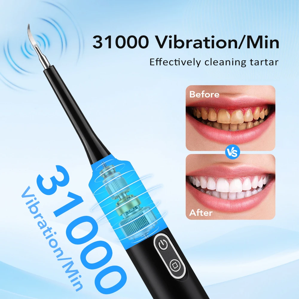 전동 음파 진동 치석 제거기 치아 미백 플라그 제거 치 - Electric Toothbrush Sonic 리뷰 및 가격